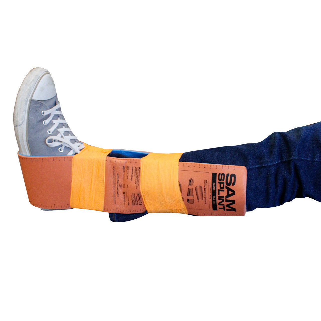 SAM Splint in use on leg