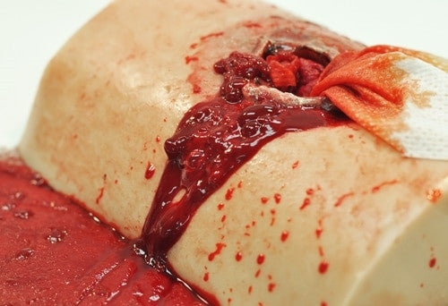 Simulated Hemostatic Gauze by TrueClot stuffed in gunshot wound