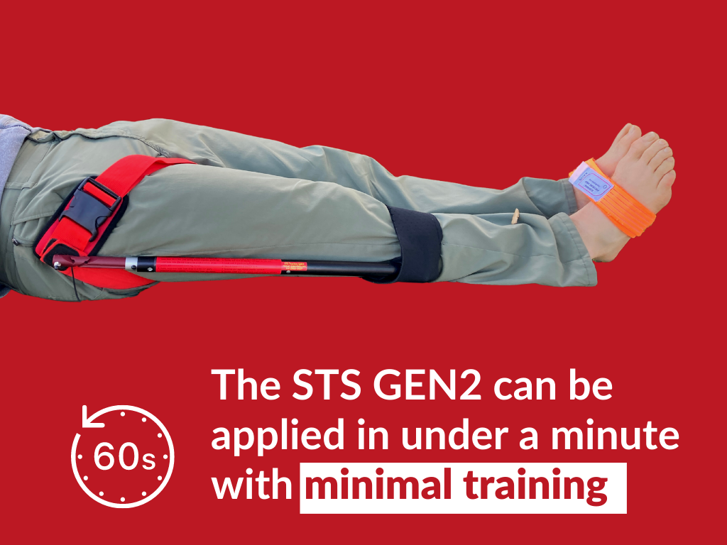 The Slishman Traction Splint (STS) Gen2 graphic, Minimal training