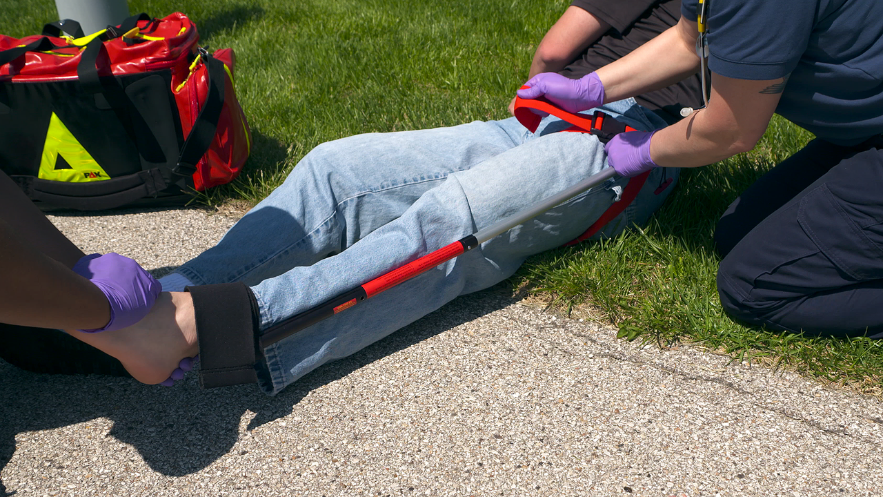 The Slishman Traction Splint (STS) Gen2 in use on leg