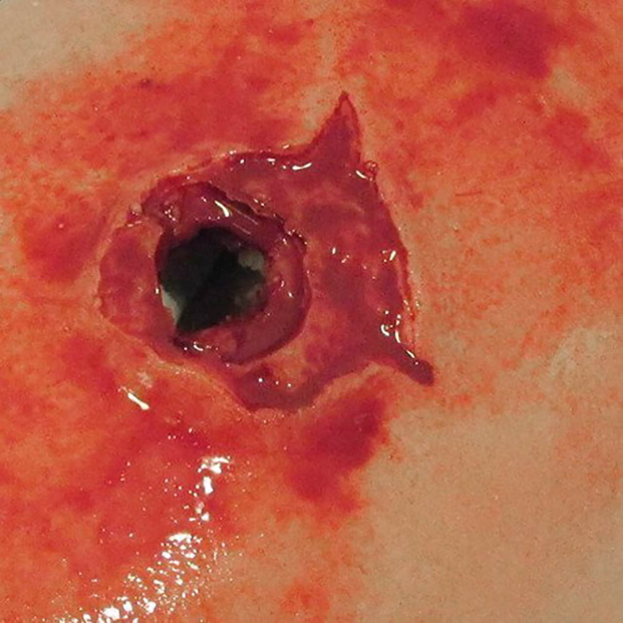 TrueClot® Wound Packing Training Kit close up of gunshot wound
