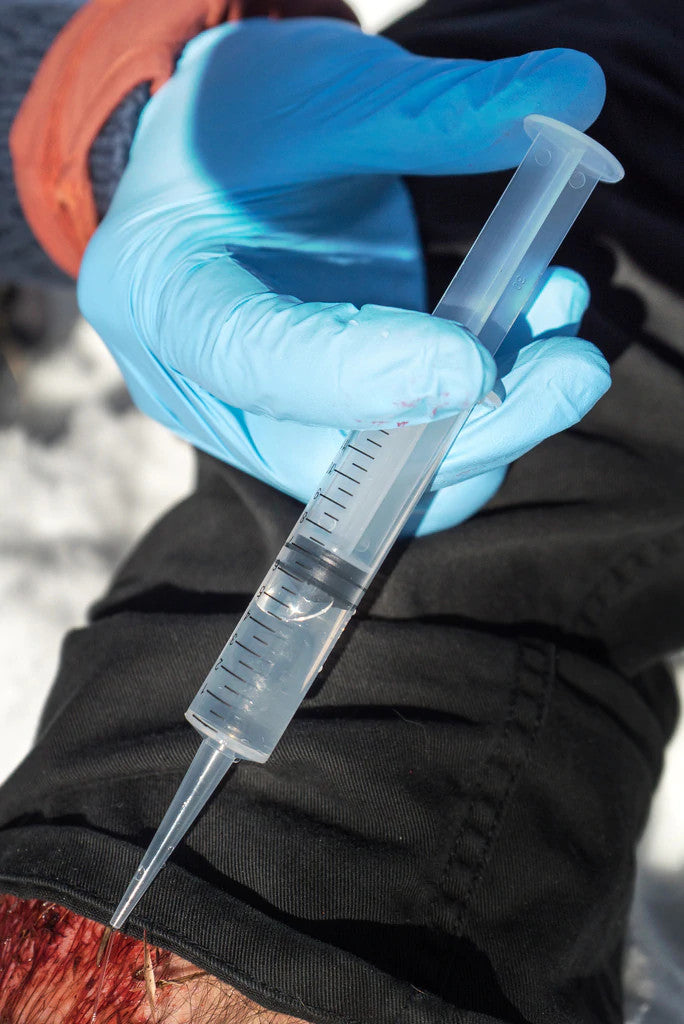 12cc Irrigation Syringe, in use