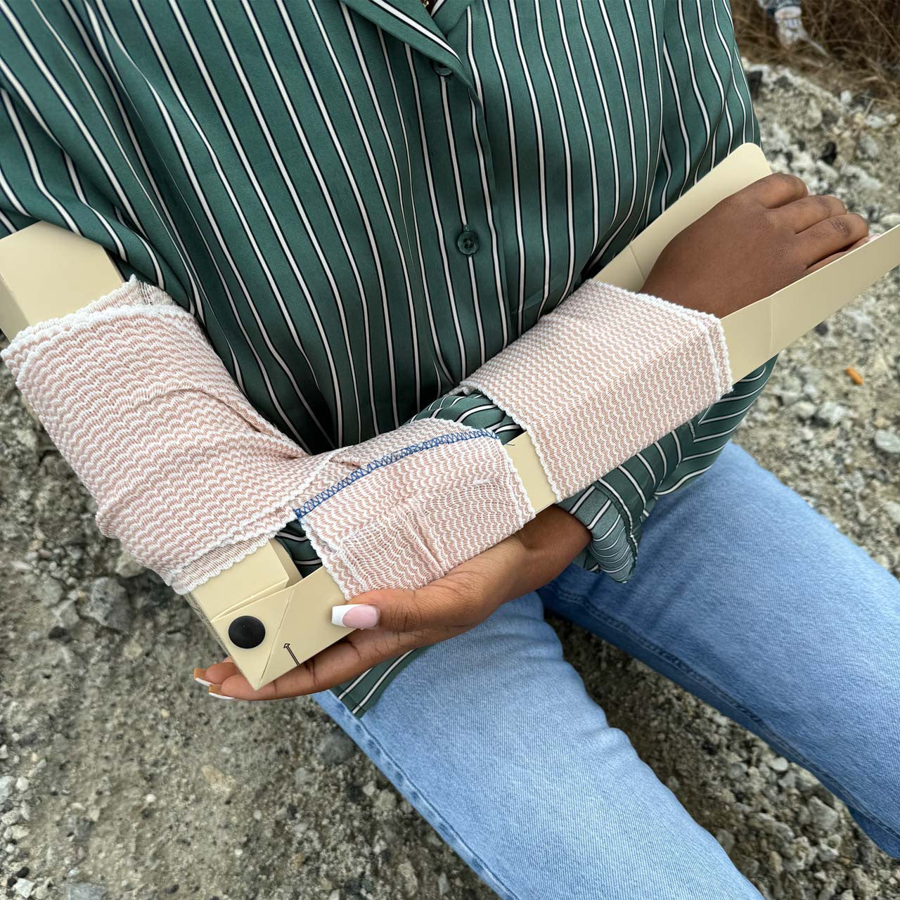 RISE™ Rigid Immobilization System for Extremities, In use on arm