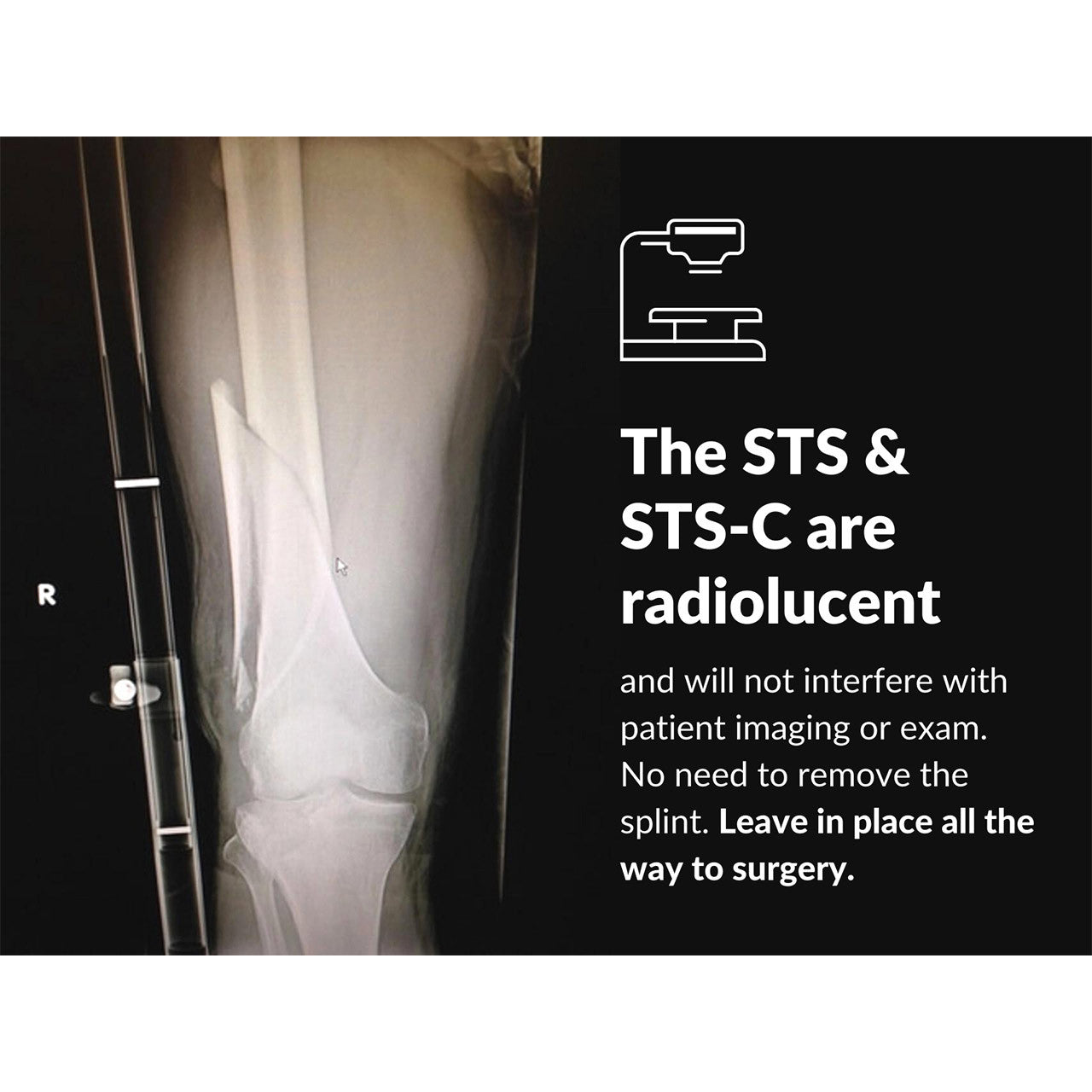 Slishman Traction Splint Compact (STS-C) by rescue essentials is radiolucent