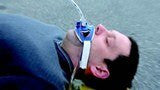 Laerdal Thomas Endotracheal Tube Holder, in use