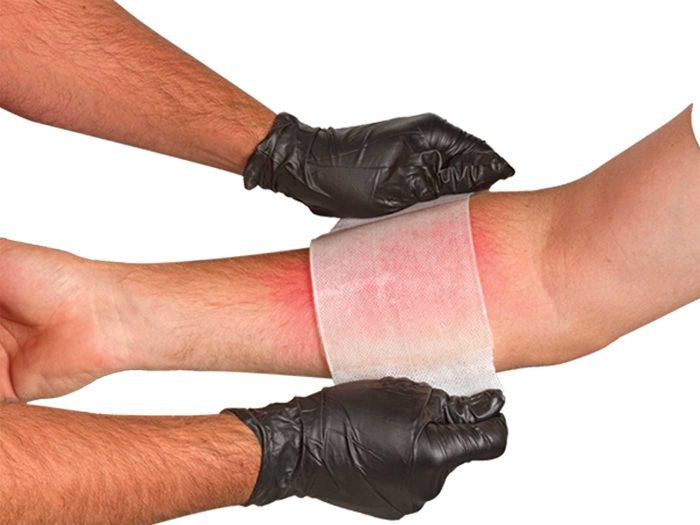 BurnTec® Dressing, on arm
