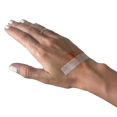 Steri-Strip™ Reinforced Skin Closure, on hand