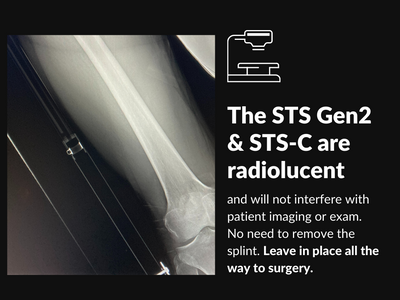 x-ray image of Slishman Traction Splint - STS