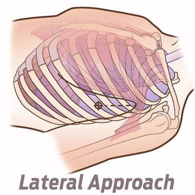 NAR SPEAR, graphic