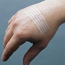 Reinforced Skin Closures, on hand