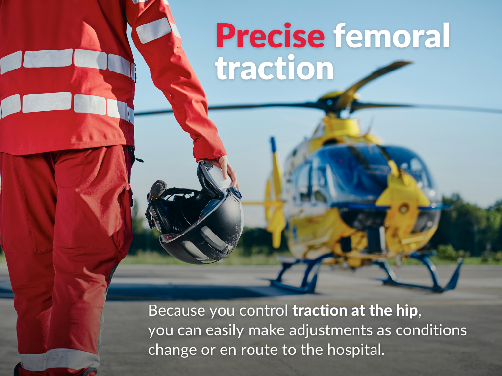 The Slishman Traction Splint (STS) Gen2 precise femoral traction