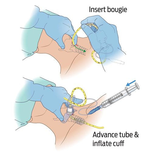 Bac-Pack, graphic