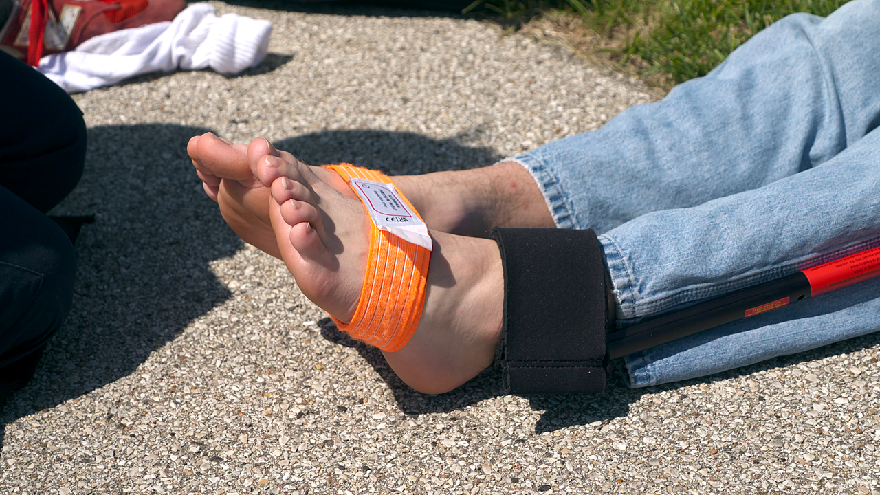The Slishman Traction Splint (STS) Gen2  in use on foot
