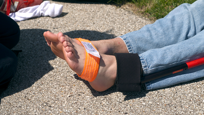 The Slishman Traction Splint (STS) Gen2  in use on foot