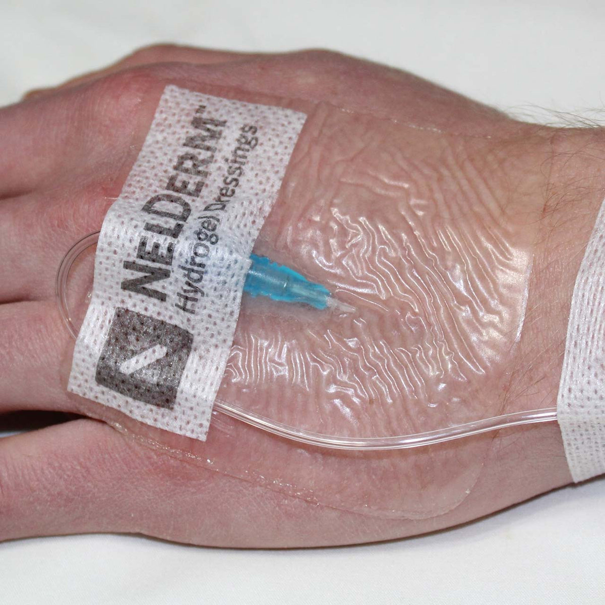BurnTec Hydrogel Dressings