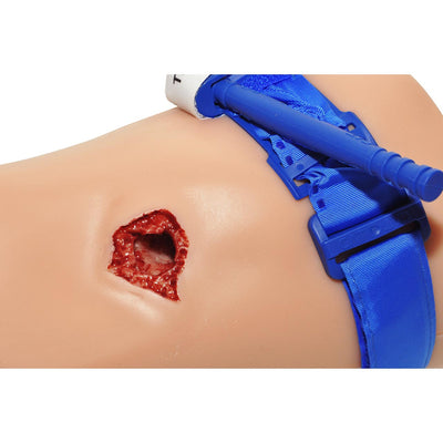 Light Tone PCT3 Leg Trainer by TrueClot close up, mounted on leg with gunshot wound