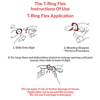 T-Ring Flex