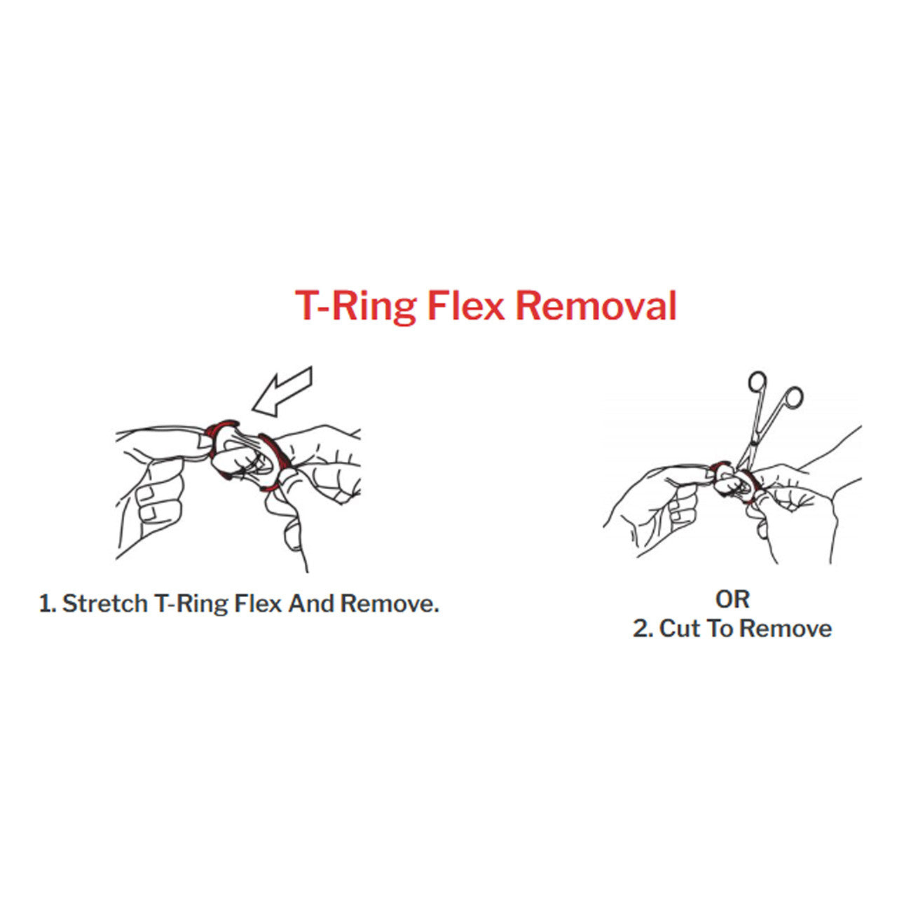 T-Ring Flex