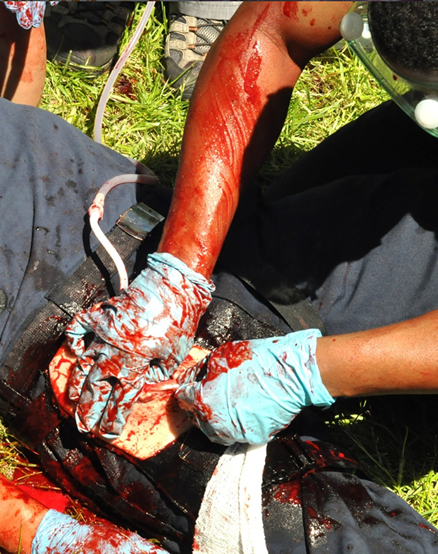 Prolonged field care