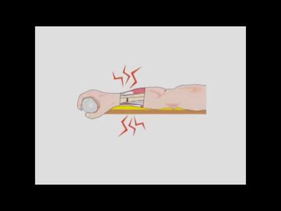 FASPLINT® Vacuum Splints