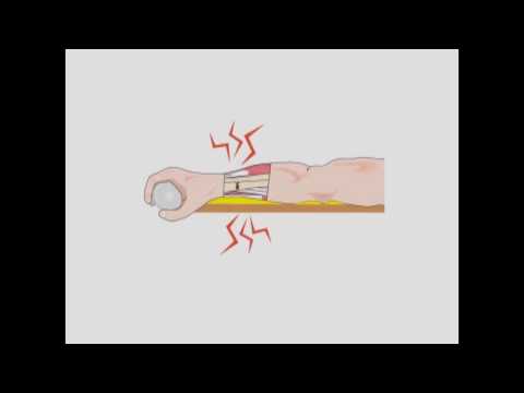 FASPLINT® Vacuum Splints