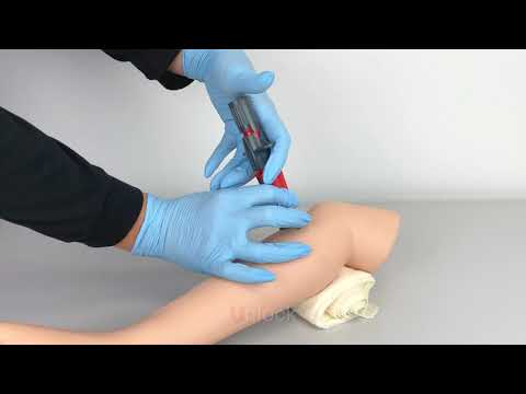 NIO Intraosseous Device