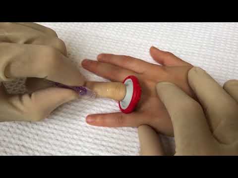 T-Strip Topical Laceration Closure