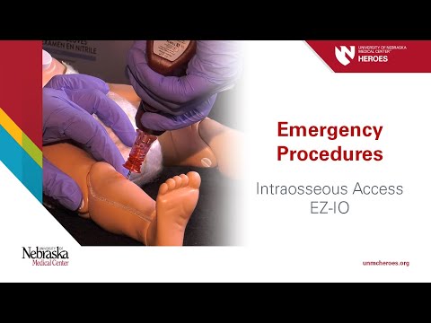 Load video: EZ-IO® EZ-Stabilizer® Dressing, Box of 5