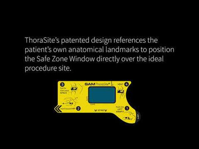 ThoraSite Anatomical Landmark Guide