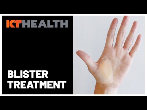 KT Blister Treatment Patch -Box of 6