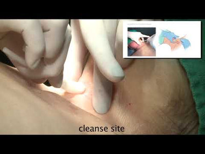 Bac-Pack - Bougie Aided Cricothyroidotomy