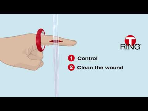 T-Ring Finger Cut Kit