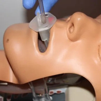 NuZone Dual-Air® Adjustable Oropharyngeal Airway, In Use