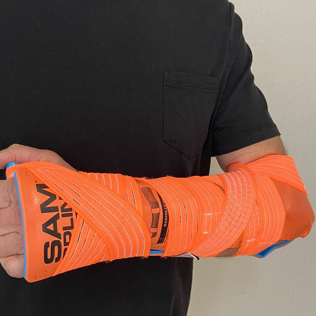 SAM Splint Combo Pack, in use on arm